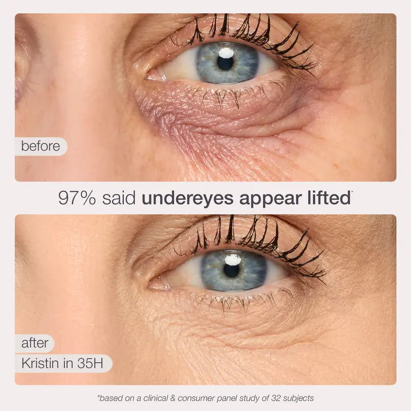 Ultimate Concealer Stick-Confidence Starts With Your Skin
