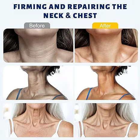 Juxek Neck Firming Cream Reduces Wrinkles and Double Chin,Five Rollers for All Around Massage