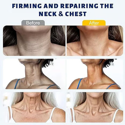 Juxek Neck Firming Cream Reduces Wrinkles and Double Chin,Five Rollers for All Around Massage