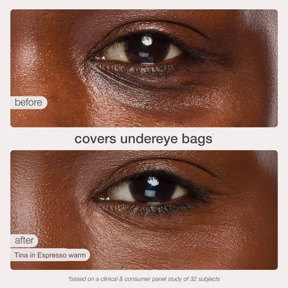 Ultimate Concealer Stick-Confidence Starts With Your Skin