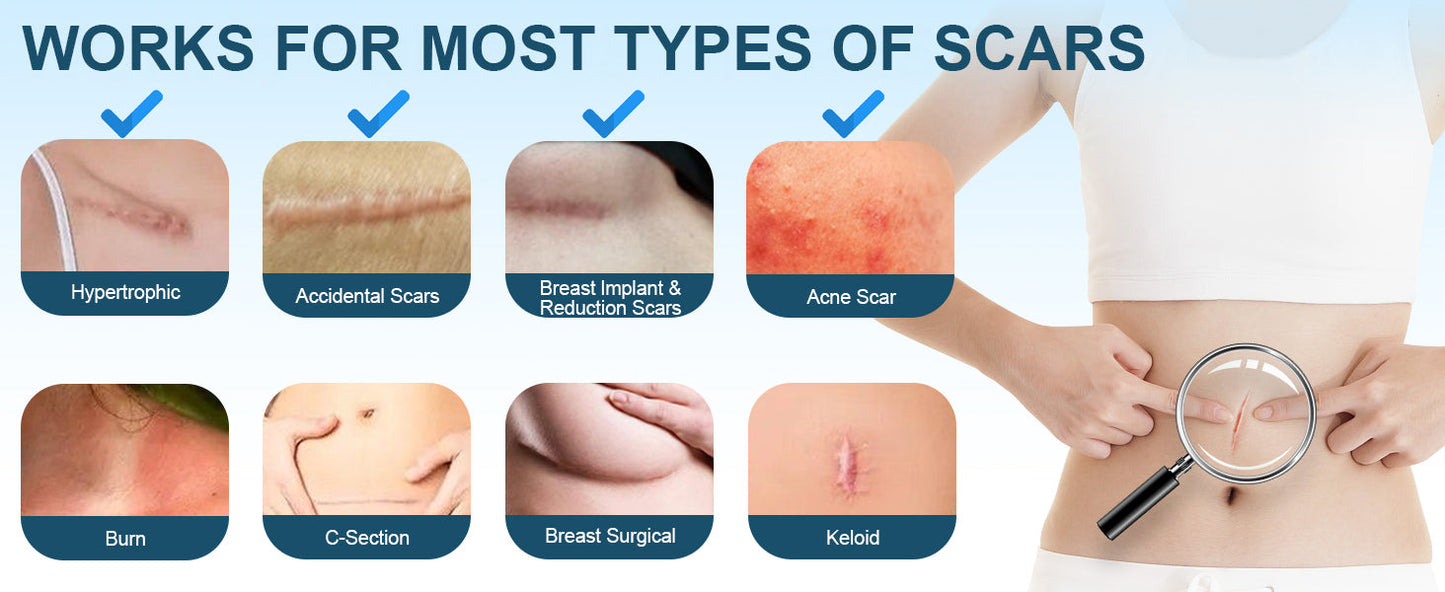 Advanced Scar Gel, Silicone Scar Gel, Treats Old and New Scars, Reduces the Appearance of Scars from, Body, Face, Stretch Marks, Surgical Scar, Keloids, Acne