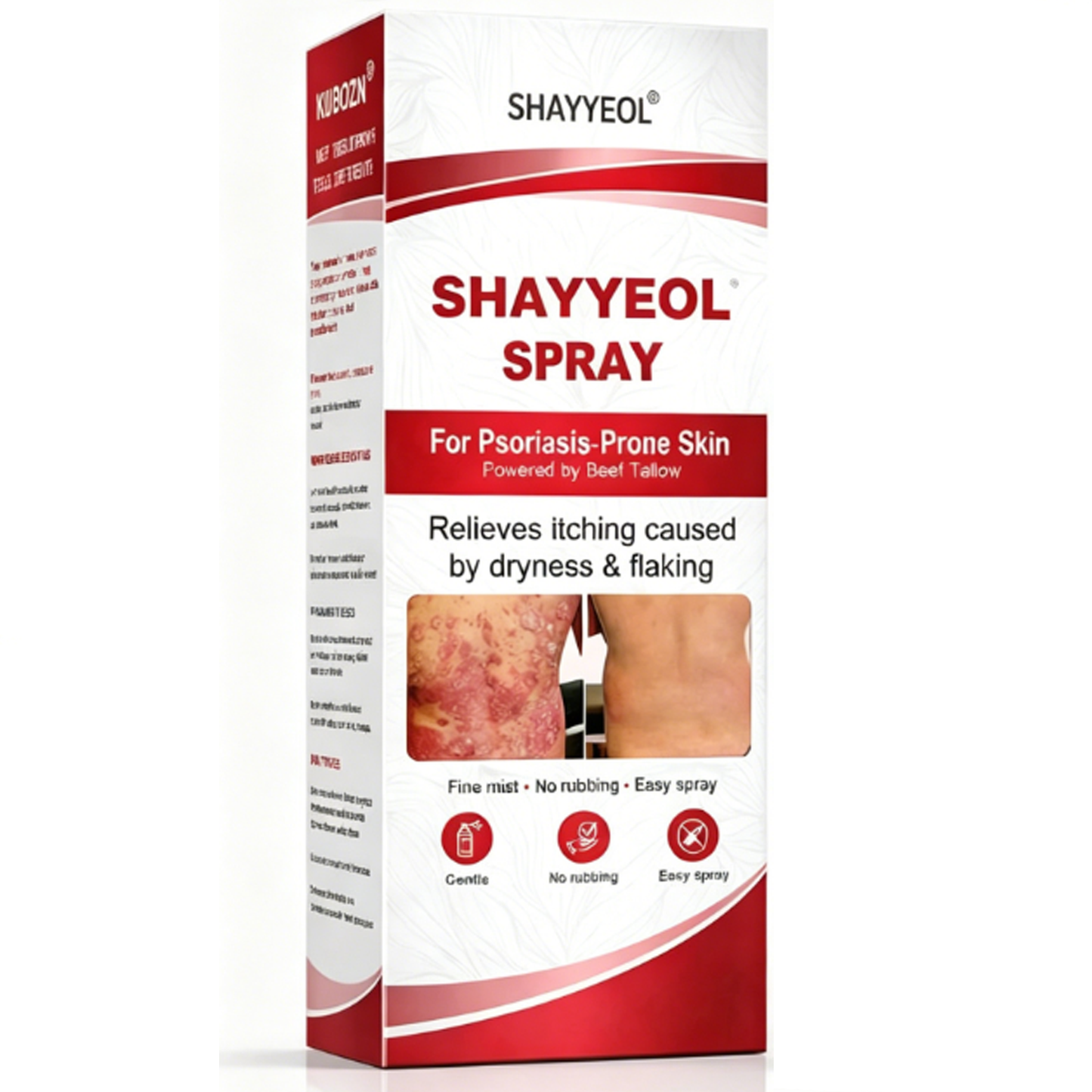 Beef Tallow Spray — Soothe & Repair Psoriasis Skin Fast | No-Rub ✨